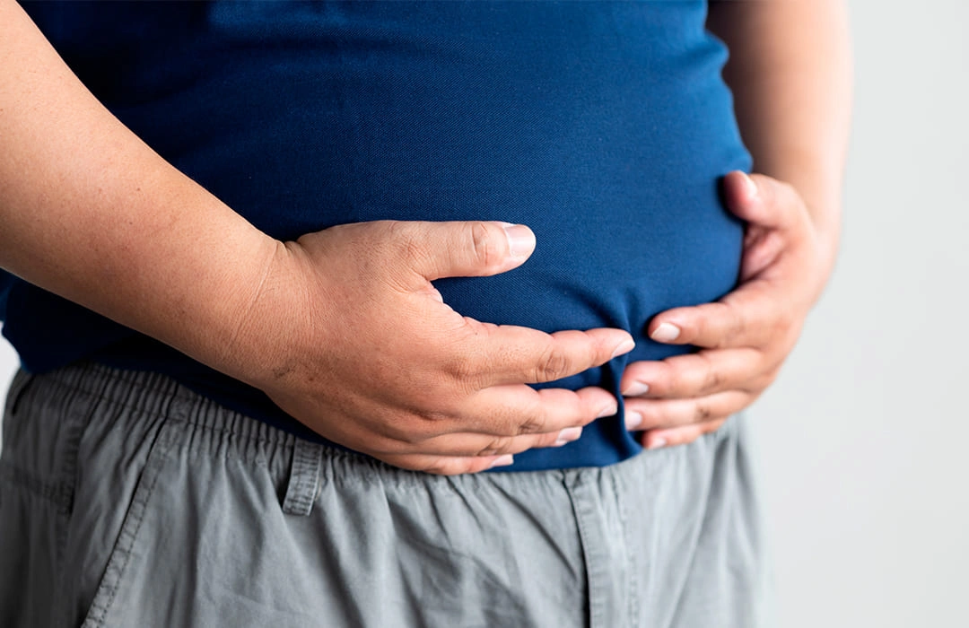 Tudo o que você precisa saber sobre obesidade e esteatose hepática não-alcoólica 